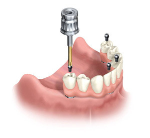 immagine dentista specializzato